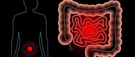 为IBD患者行内镜监测的10大实操建议